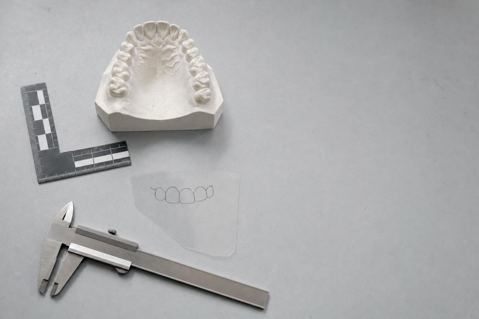 A bone-white dental stone cast of an upper dental arch on a cool grey surface, a translucent acetate overlay traced with the biting edges of the teeth lying beside it, next to a matte L-shaped forensic photographic scale, under even clinical light.